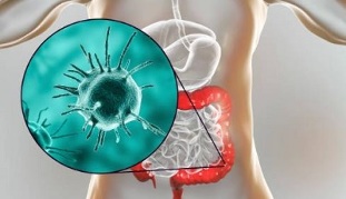 welche Tests für Parasiten zu nehmen