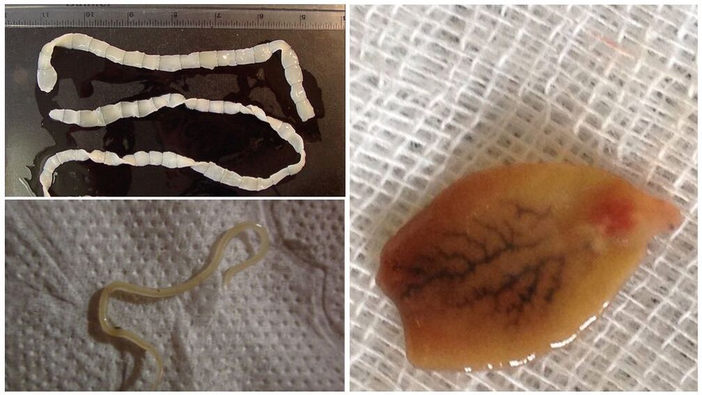 أنواع الطفيليات