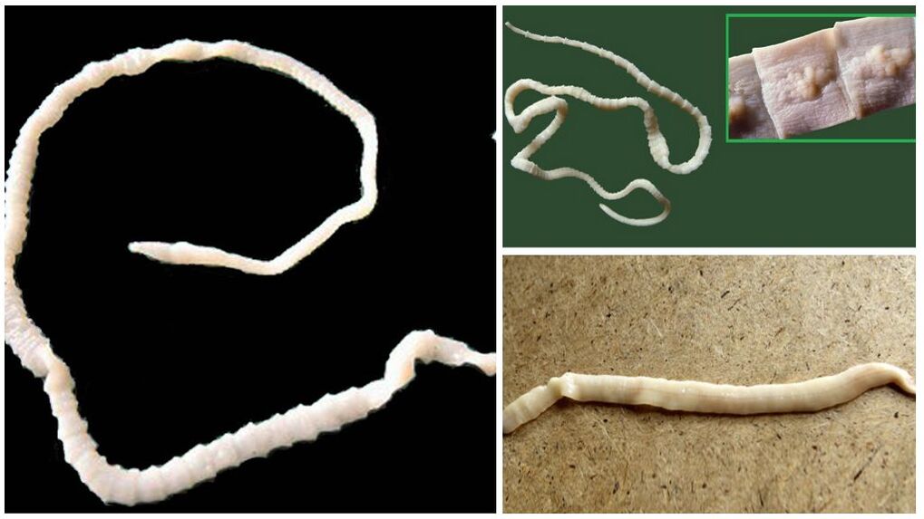 الديدان الخيطية