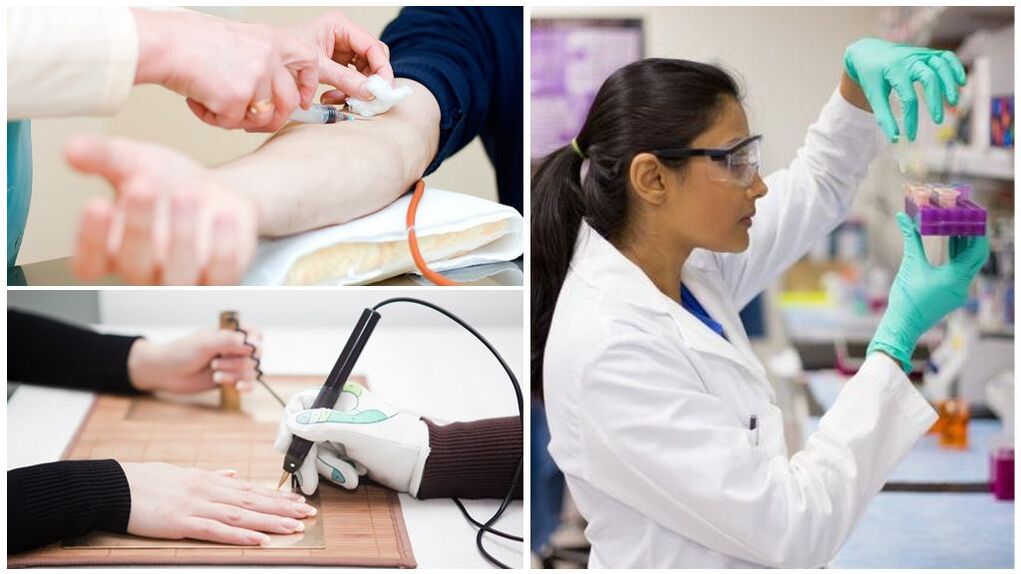 طرق تشخيصية للكشف عن الطفيليات في الجسم