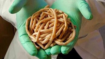 طرق القضاء على الطفيليات من الجسم